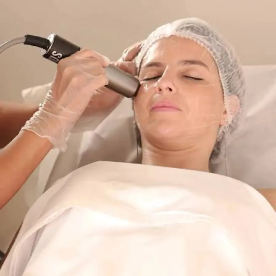 Sessão de ultrassom microfocado (HIFU)
